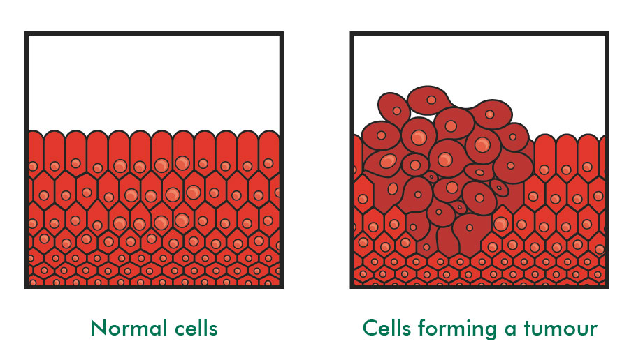 The Importance Of Cancer Cells In Tumours