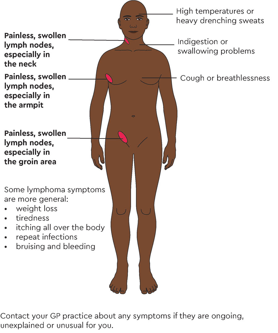 swollen lymph node neck