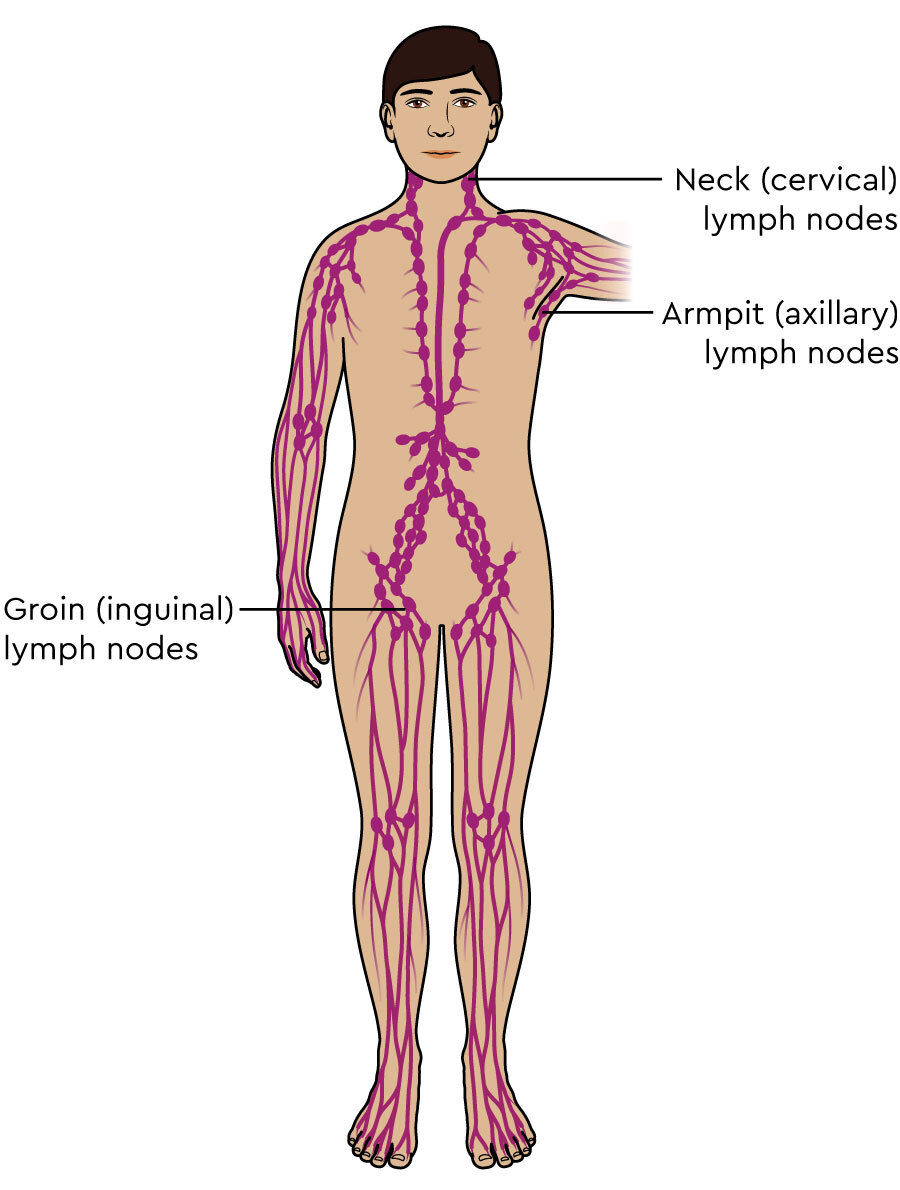 location of lymph nodes lymphoma