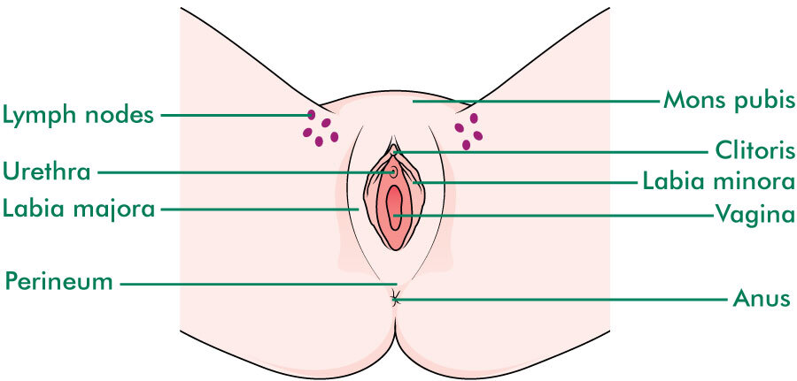The vulva - vulval cancer and lymph nodes in the groin