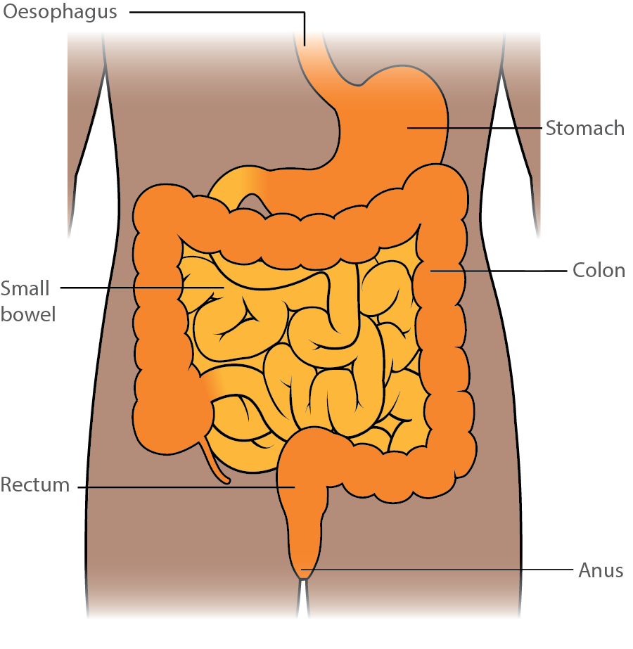 Gastrointestinal stromal tumour