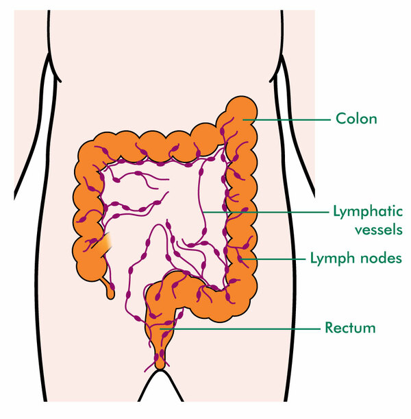 Bowel Cancer And The Lymphatic System Macmillan Cancer Support