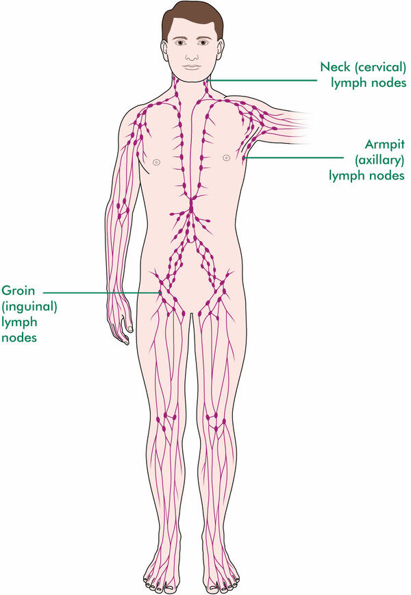 What Happens When Cancer Spreads To The Lymph Nodes Macmillan Cancer Support