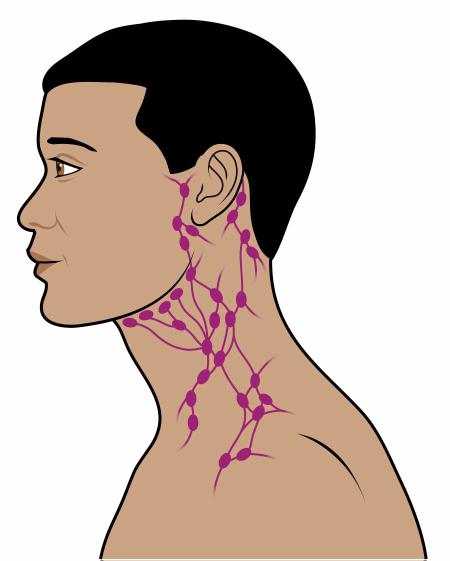 swollen lymph node neck