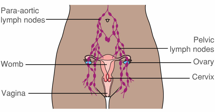 The Vulva Vulval Cancer And Lymph Nodes In The Groin Macmillan Cancer Support