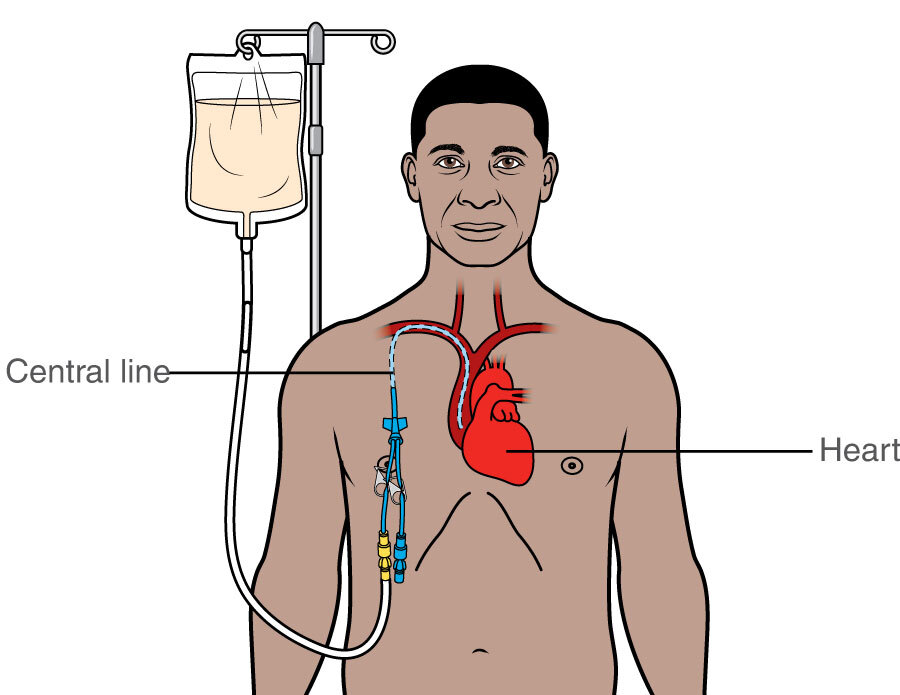 total-parenteral-nutrition-calculations-guidelines-60-off