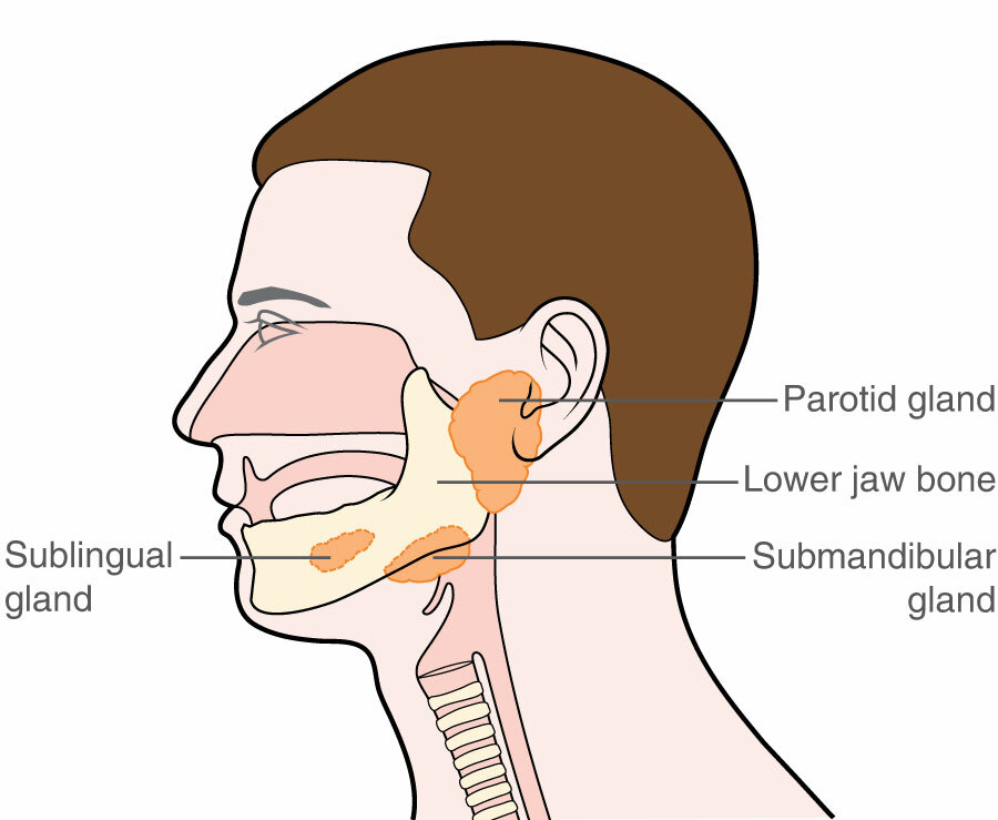 submandibular tumor